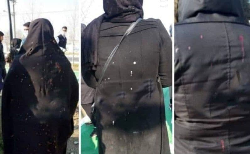 اسیدپاشی به چند زن در تهران
