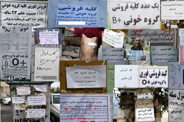 فقر و بازار فروش اعضا بدن در ایران