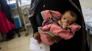 بحران غذا در افغانستان و جان باختن هزاران نوزاد